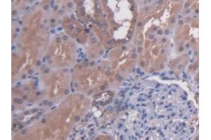 DAB staining on IHC-P; Samples: Human Kidney Tissue (N-Acetyl alpha-D-Glucosaminidase (AA 485-743) anticorps)