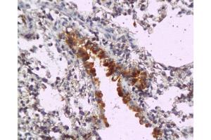 Formalin-fixed and paraffin embedded mouse lung tissue labeled with Anti-MyD88 Polyclonal Antibody, Unconjugated  at 1:200, followed by conjugation to the secondary antibody and DAB staining