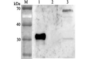 Western blot analysis using anti-ANGPTL4 (human), pAb  at 1:2'000 dilution. (ANGPTL4 anticorps)