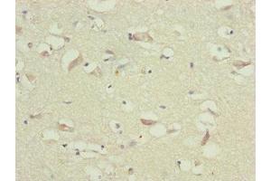 Immunohistochemistry of paraffin-embedded human brain tissue using ABIN7173719 at dilution of 1:100