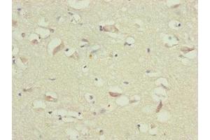 Immunohistochemistry of paraffin-embedded human brain tissue using ABIN7173719 at dilution of 1:100 (TTLL7 anticorps  (AA 1-260))