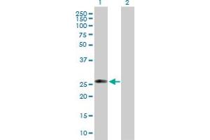 Western Blot analysis of C1QTNF5 expression in transfected 293T cell line by C1QTNF5 MaxPab polyclonal antibody.