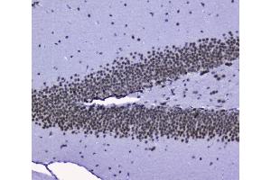 IHC analysis of nmt55/p54nrb using anti-nmt55/p54nrb antibody (ABIN3044530).