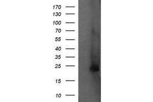 Image no. 2 for anti-Fetal and Adult Testis Expressed 1 (FATE1) antibody (ABIN1498223) (FATE1 anticorps)