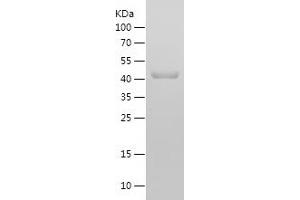Western Blotting (WB) image for Insulin-Like Growth Factor 1 Receptor (IGF1R) (AA 741-935) protein (His-IF2DI Tag) (ABIN7123451)