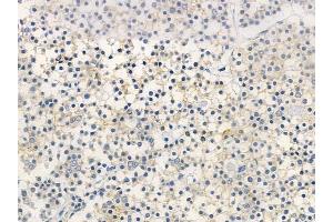 ABIN6261574 and ABIN6266963 at 1/100 staining human pituitary adenoma by IHC-P. (Epsin 1 anticorps)
