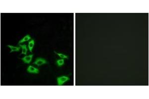 Immunofluorescence analysis of A549 cells, using FZD8 Antibody. (FZD8 anticorps  (AA 31-80))