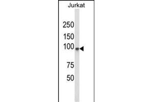 Western blot analysis of PLCL1 Antibody (N-term) (ABIN652796 and ABIN2842522) in Jurkat cell line lysates (35 μg/lane). (PLCL1 anticorps  (N-Term))