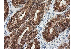 Image no. 1 for anti-Hydroxyprostaglandin Dehydrogenase 15-(NAD) (HPGD) antibody (ABIN1496363) (HPGD anticorps)