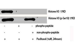 Western Blot analysis of various cells using Phospho-Histone H3 (S10) Polyclonal Antibody (HIST1H3A/HIST2H3A/H3F3A (pSer10) anticorps)