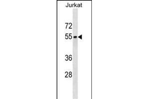 SEPT6 Antibody (C-term) (ABIN1537277 and ABIN2850133) western blot analysis in Jurkat cell line lysates (35 μg/lane). (Septin 6 anticorps  (C-Term))