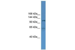 WB Suggested Anti-UBA6 Antibody Titration: 0. (UBA6 anticorps  (Middle Region))