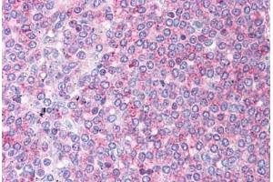 Human Spleen: Formalin-Fixed, Paraffin-Embedded (FFPE)