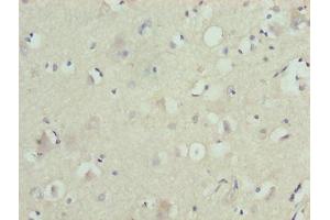 Immunohistochemistry of paraffin-embedded human brain tissue using ABIN7176547 at dilution of 1:100