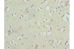 Immunohistochemistry of paraffin-embedded human brain tissue using ABIN7176547 at dilution of 1:100 (ZNF821 anticorps  (AA 1-370))