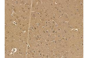 PUF60 Mouse Monoclonal Antibody at 1/100 staining rat brain tissue by IHC-P. (PUF60 anticorps)
