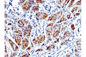 Formalin-fixed, paraffin-embedded human Uterus stained with Caldesmon Rabbit Recombinant Monoclonal Antibody (CALD1/1424R). (Recombinant Caldesmon anticorps)