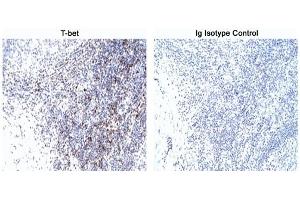 Immunohistochemistry (IHC) image for anti-T-Bet antibody (ABIN967673) (T-Bet anticorps)