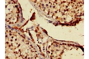 Immunohistochemistry of paraffin-embedded human testis tissue using ABIN7147226 at dilution of 1:100 (MNAT1 anticorps  (AA 1-309))