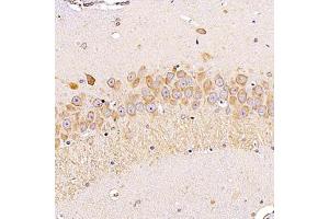 Immunohistochemistry analysis of paraffin-embedded rathippocampususing ALG6 (ABIN7073127) at dilution of 1:1200