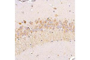 Immunohistochemistry analysis of paraffin-embedded rathippocampususing ALG6 (ABIN7073127) at dilution of 1:1200 (ALG6 anticorps)