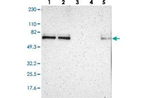 Western blot analysis of Lane 1: RT-4, Lane 2: U-251 MG, Lane 3: Human Plasma, Lane 4: Liver, Lane 5: Tonsil with ZNF384 polyclonal antibody  at 1:250-1:500 dilution. (ZNF384 anticorps)