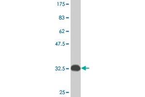 Western Blot detection against Immunogen (33. (ATOX1 anticorps  (AA 1-68))