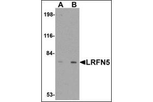 Western blot analysis of LRFN5 in EL4 cell lysate with this product at (A) 0. (LRFN5 anticorps  (C-Term))