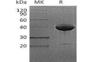 Western Blotting (WB) image for Tumor Necrosis Factor Receptor Superfamily, Member 17 (TNFRSF17) protein (Fc Tag) (ABIN7320975)