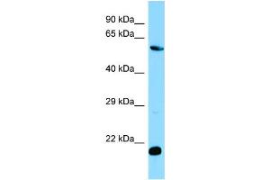 WB Suggested Anti-MOB1B Antibody Titration: 1. (MOBKL1A anticorps  (C-Term))