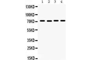 Western Blotting (WB) image for anti-Fragile X Mental Retardation 1 (FMR1) (AA 164-200), (N-Term) antibody (ABIN3042398) (FMR1 anticorps  (N-Term))