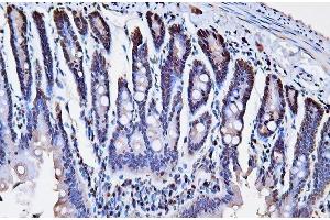 IHC analysis of PCNA using anti-PCNA antibody (ABIN7599181).