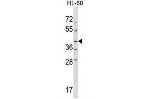 NPRL2 Antibody (C-term) western blot analysis in HL-60 cell line lysates (35µg/lane). (NPRL2 anticorps  (C-Term))
