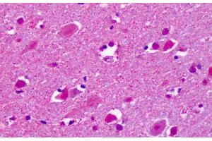 Anti-CELSR2 antibody IHC staining of human brain, cortex, neurons. (CELSR2 anticorps  (C-Term))