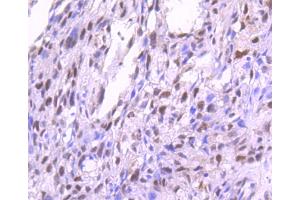 anti-Protein Kinase C, alpha (PKCa) (pThr638) antibody