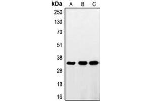 Western blot analysis of RNF144A expression in HeLa (A), HepG2 (B), Jurkat (C) whole cell lysates. (RNF144A anticorps  (Center))