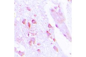 Immunohistochemical analysis of ABHD12B staining in human brain formalin fixed paraffin embedded tissue section. (ABHD12B anticorps  (C-Term))