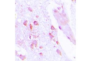 Immunohistochemical analysis of ABHD12B staining in human brain formalin fixed paraffin embedded tissue section. (ABHD12B anticorps  (C-Term))