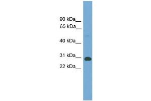 WB Suggested Anti-Tgifx1 Antibody Titration:  0. (TGIF2LX anticorps  (Middle Region))