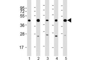 Western blot testing of human 1) 293T/17, 2) A431, 3) HeLa, 4) Jurkat and 5) K562 cell lysate with PHF6 antibody at 1:2000. (PHF6 anticorps  (AA 315-349))