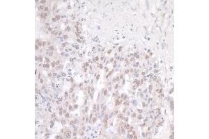 Immunohistochemistry (IHC) image for anti-Fused in Sarcoma (FUS) (AA 1-50) antibody (ABIN7448573)