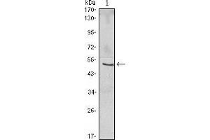Western blot analysis using NFKBIB mouse mAb against Jurkat (1) cell lysate. (NFKBIB anticorps)
