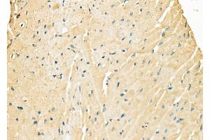ABIN6263151 and ABIN6278130 at 1/100 staining Rat heart tissue by IHC-P.