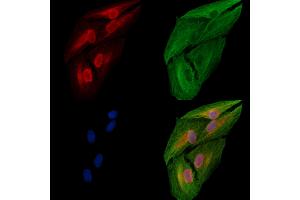 ABIN6258507 and ABIN6274710 staining  cells by IF/ICC.