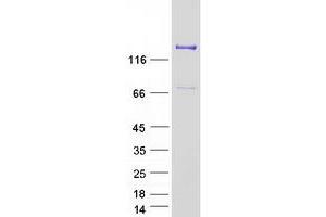 Validation with Western Blot