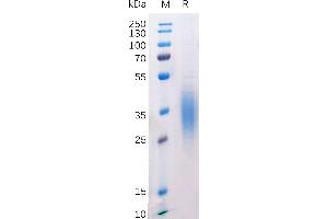 Mouse BTLA Protein, His Tag on SDS-PAGE under reducing condition.