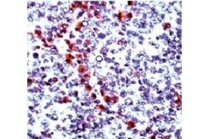 Formalin fixed paraffin embedded human tonsil stained with Granzyme B antibody. (GZMB anticorps  (N-Term))