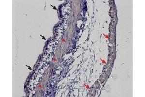 Expression of TRPM2 in rat lung - Immunohistochemical staining of rat lung paraffin embedded sections using Anti-TRPM2 Antibody (ABIN7043829, ABIN7044006 and ABIN7044007), (1:100).