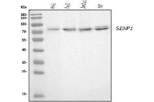 Western blot analysis of SENP1 using anti-SENP1 antibody (ABIN7600423).