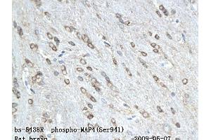 Formalin-fixed and paraffin embedded rat colitis labeled with Anti-phospho-MAP4(Ser941) Polyclonal Antibody, Unconjugated (ABIN802068) followed by conjugation to the secondary antibody and DAB staining (MAP4 anticorps  (pSer941))